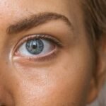 Infecciones oculares: causas, tratamiento y prevención